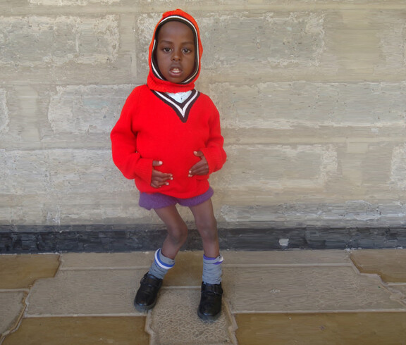 Ein Junge in rotem Pullover mit schiefgewachsenen Beinen steht vor einer Mauer.